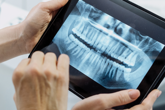 Pensioners Dental Services Plan Dental x-ray.