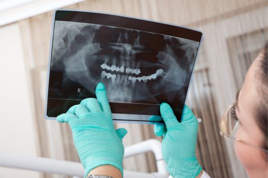 Dentiste avec une radiographie.